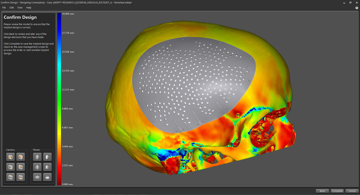 Renishaw_Maxillofacial.jpg